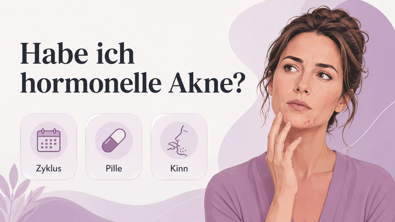 Illustration einer Frau mit Pickeln am Kinn, dazu Symbole für Zyklus, Pille und Kinn als Hinweise auf hormonelle Akne